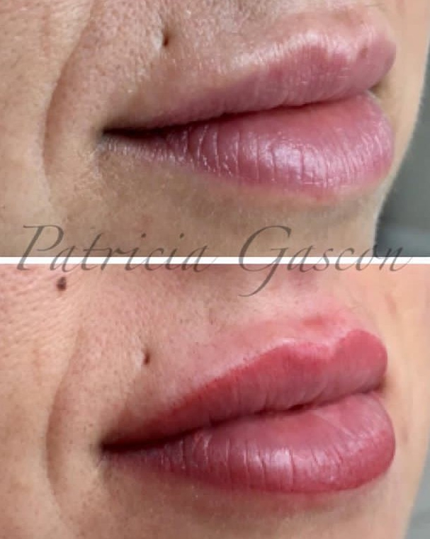 labios1 labios1
